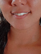 anelimol5986